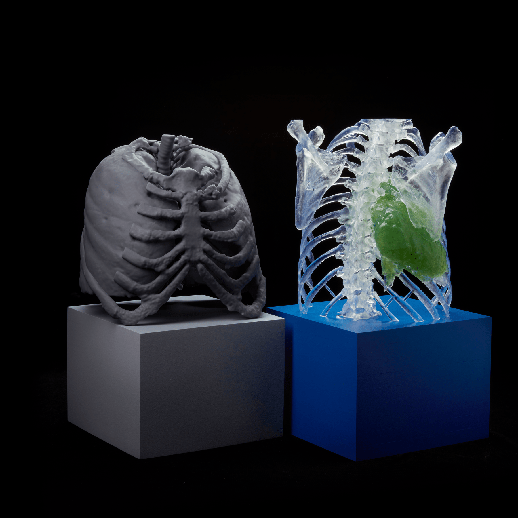 3D Printed Medical parts