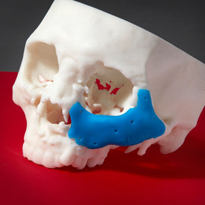 cyan colour on formlabs 3d printed skull